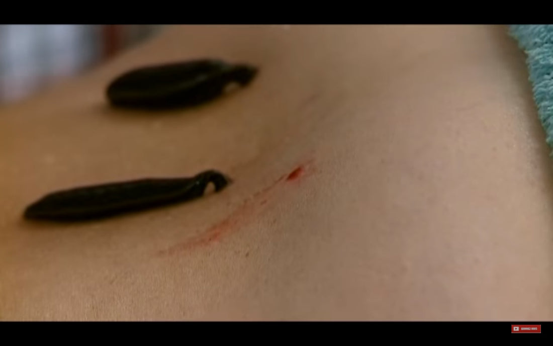 Video: Des sangsues qui soignent