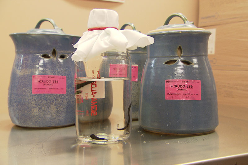 Leech therapy in the Vienna hospital