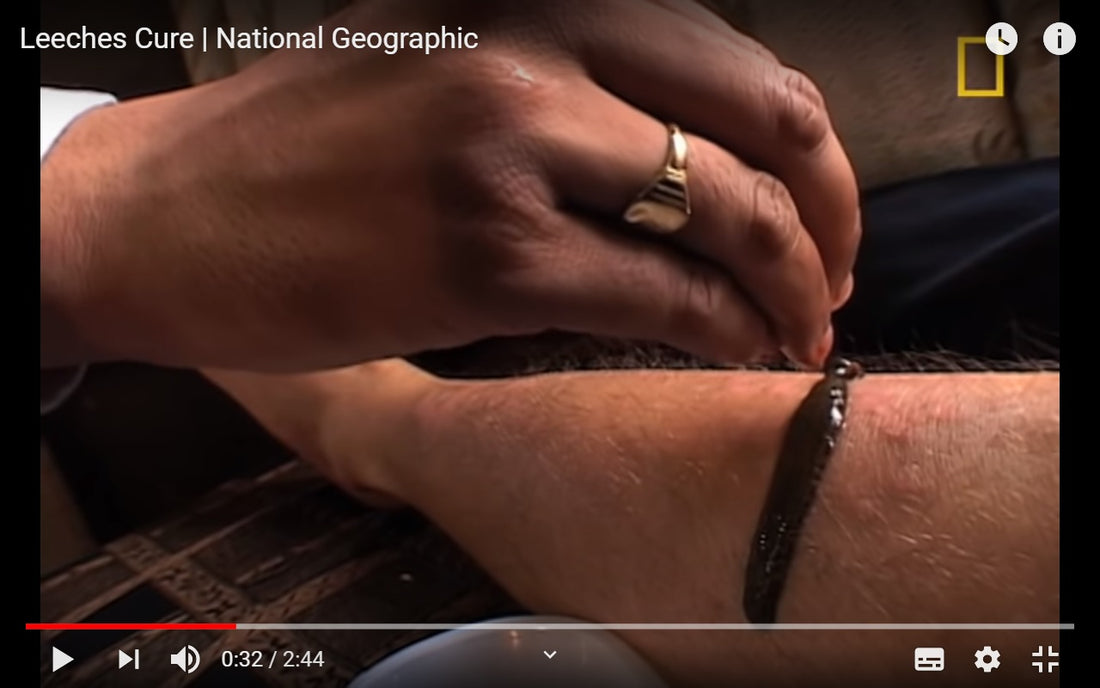 Video: National Geographic Leech Cure in India