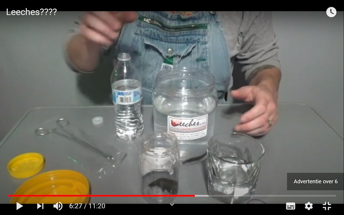 Video: Brad receives a delivery of leeches and accessories