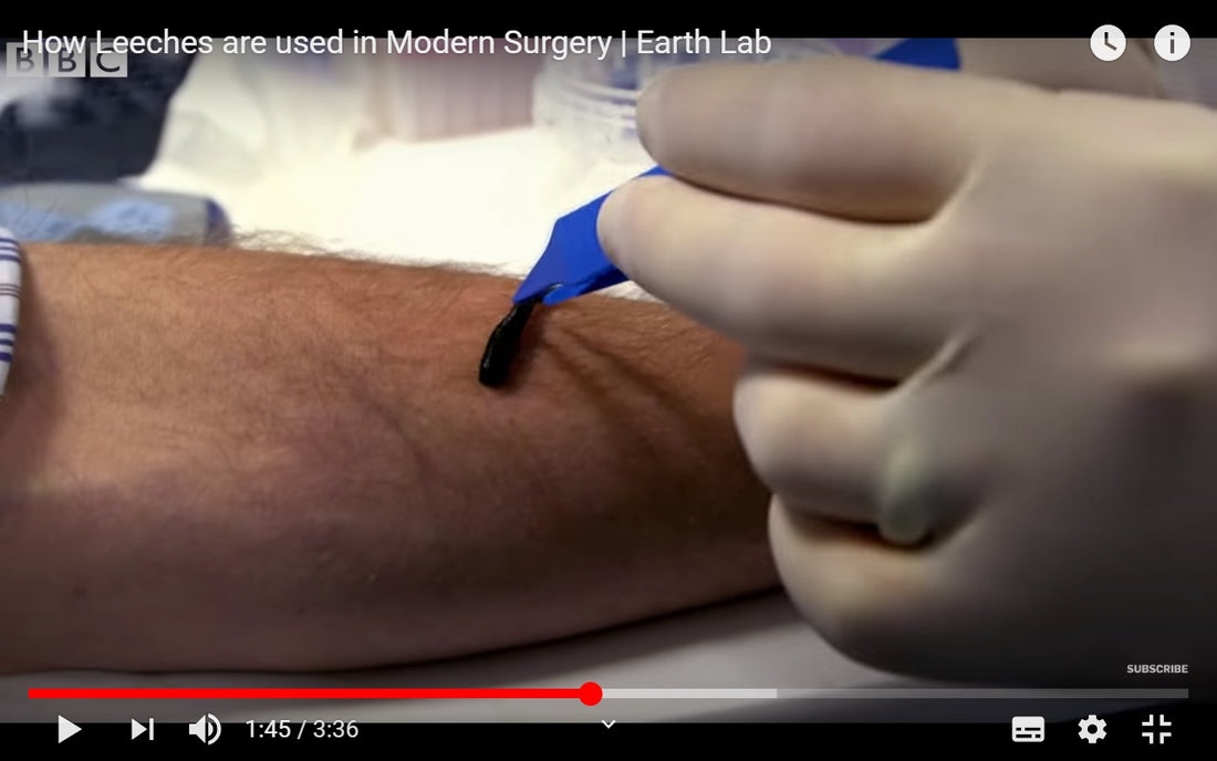 Video: How Leeches are used in Modern Surgery